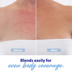 Dr. Denese Glow Younger Body Concealer 3.4 Oz – Leg & Body Makeup For Veins, Bruises, Scars, Discoloration, Age And Sun Spots – Full Coverage Concealer & Hydrating Transfer-Resistant Cream – Natural