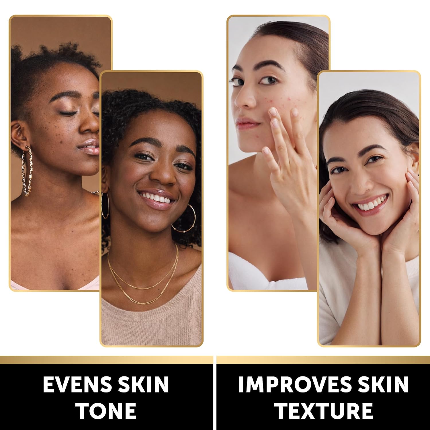 Valitic Brightening Lemon & Turmeric Kojic Acid Soap With Vitamin C, Retinol, Collagen - Original Japanese Complex Infused With Hyaluronic Acid, Vitamin E, Shea Butter - Dark Spot Corrector (2 Pack)