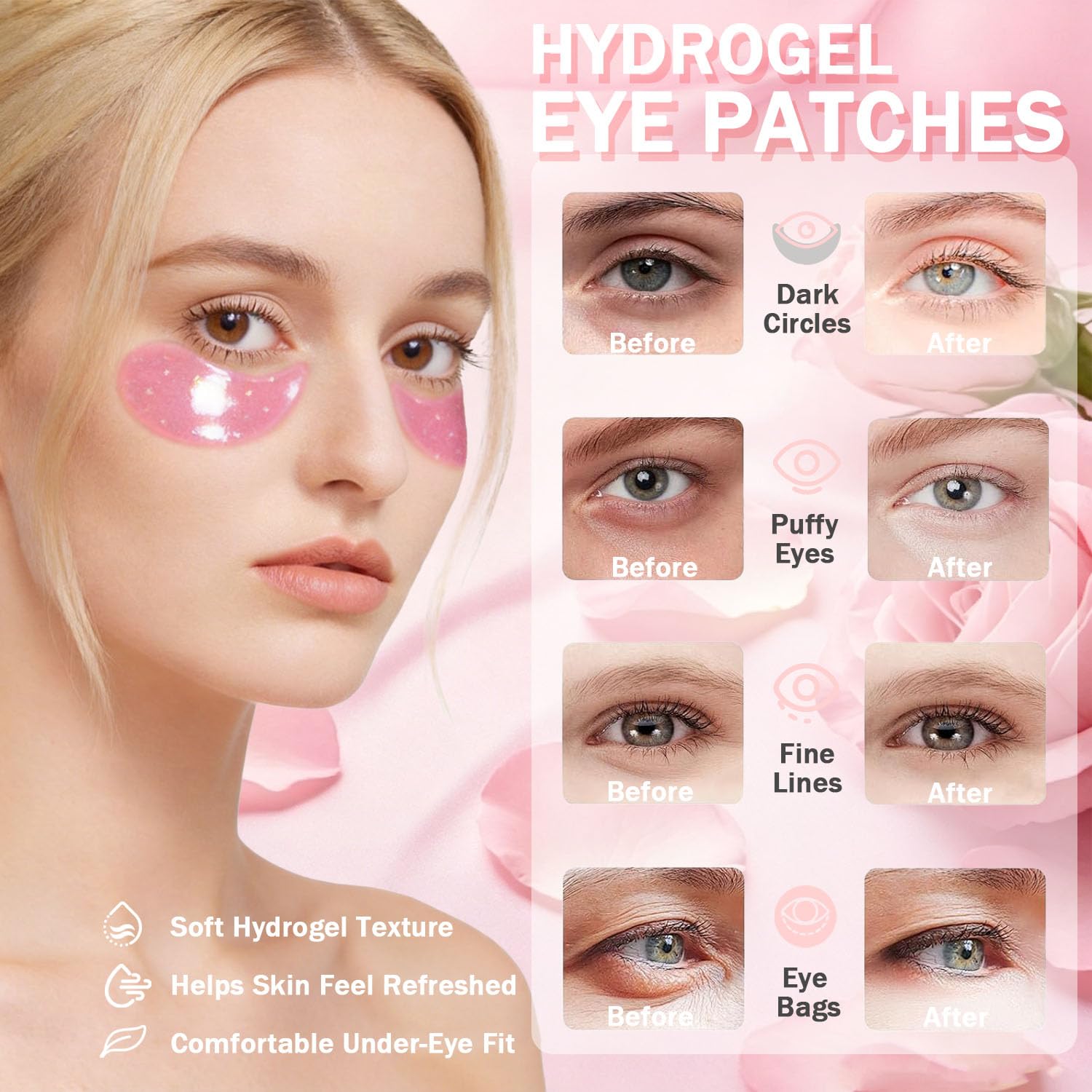 Under Eye Patches For Dark Circles (30 Pairs), Parches Para Ojeras, Eye Patches For Puffy Eyes And Dark Circles, Under Eye Mask, Hydrating Eye Mask Skincare, Eye Patches For Women, Korean Eye Patches