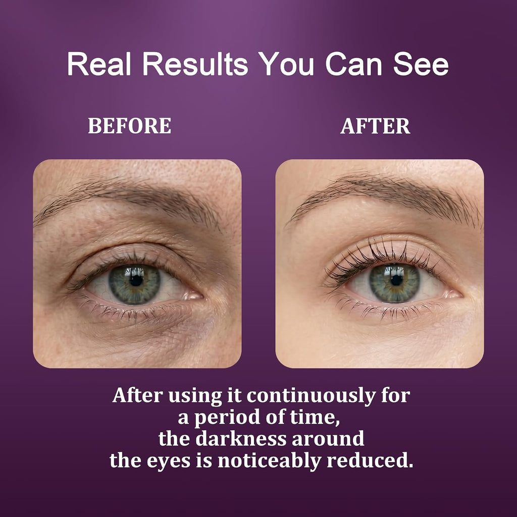 Calcium Dark Spot Eye Cream 2 Pack | Anti-Aging Eye Cream For Dark Circles, Sagging And Elasticity