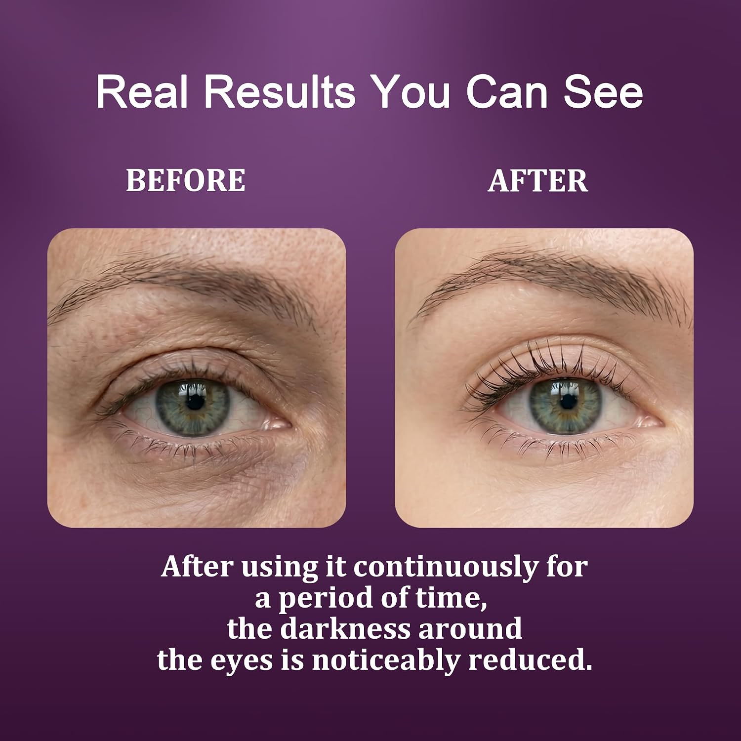 Calcium Dark Spot Eye Cream 2 Pack | Anti-Aging Eye Cream For Dark Circles, Sagging And Elasticity