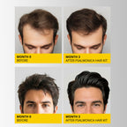 Hair Growth Shampoo And Conditioner Set: Sulfate Free Hair Growth Root Activator Thickening Shampoo For Hair Loss And Thinning Hair - Hair Loss Regrowthtreatments For Women Men