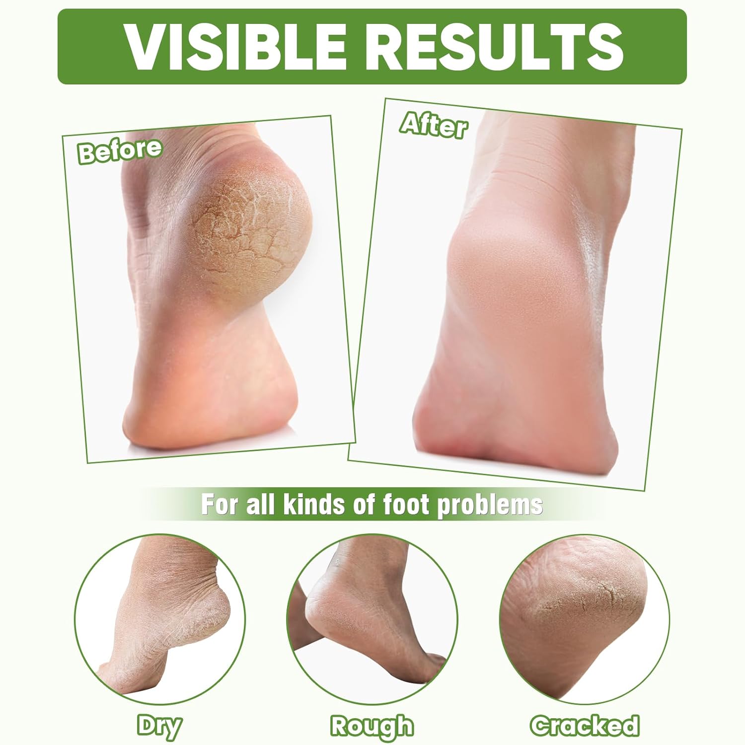 TEAWOO 24 Pairs Moisturizing Foot Masks with Aloe Vera Extract & Jojoba Oil, Intensely Hydrating Foot Mask For Dry Cracked Feet, Moisturizing Socks for Cracked Heel Treatment