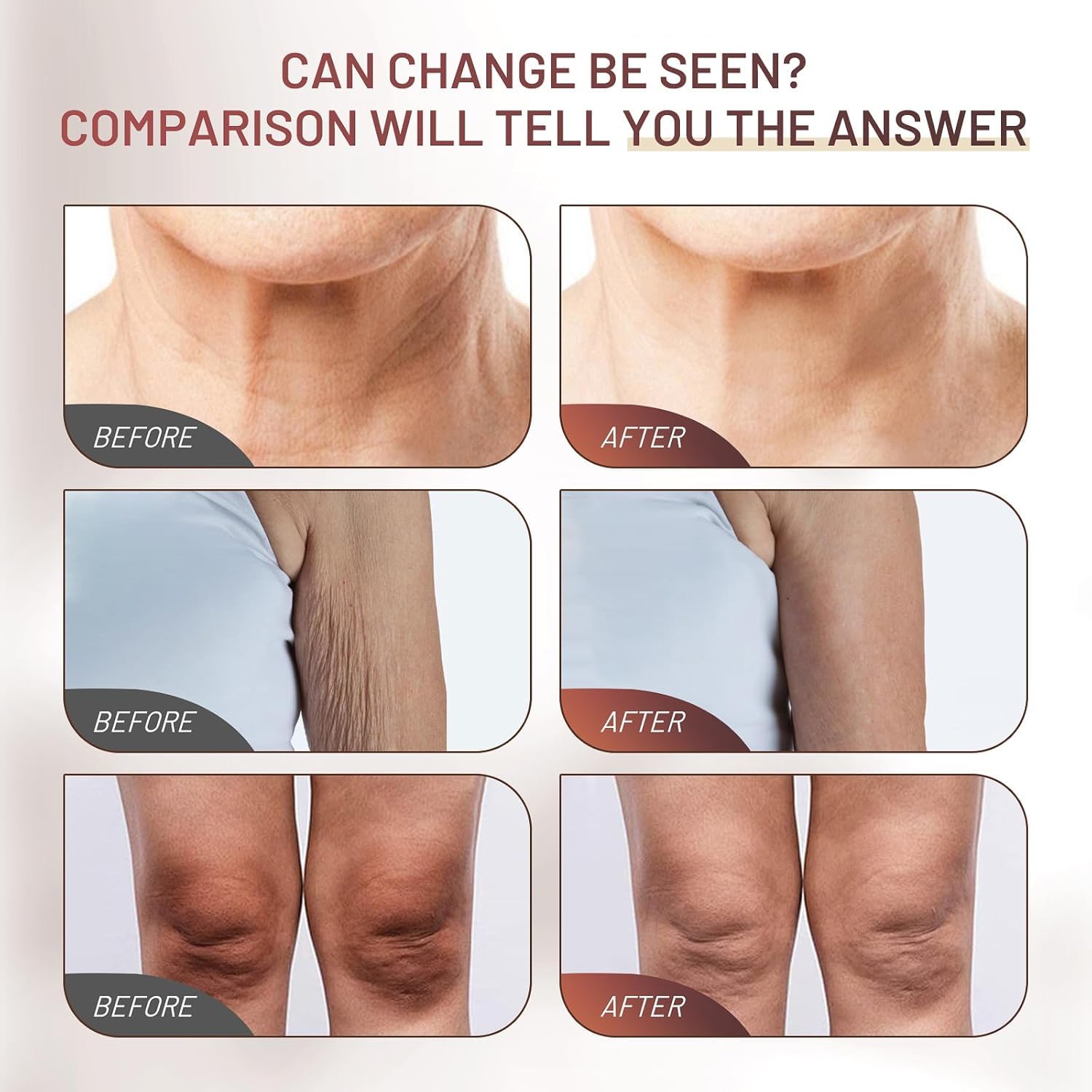 Crepe Fix Body Cream, Hydrating & Smoothing Moisturizer For Face, Neck & Body, Helps Improve The Look Of Crepey Skin, Lightweight Fast-Absorbing Formula For Women & Men, 4.21 Fl Oz