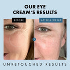 Eclat Skincare Under Eye Cream For Dark Circles & Puffiness – Anti Aging Formula For Wrinkles - Moisturizer For Fine Lines, Crows Feet & Eye Bags – Hydrating Treatment For Firming & Smoothing - 30Ml