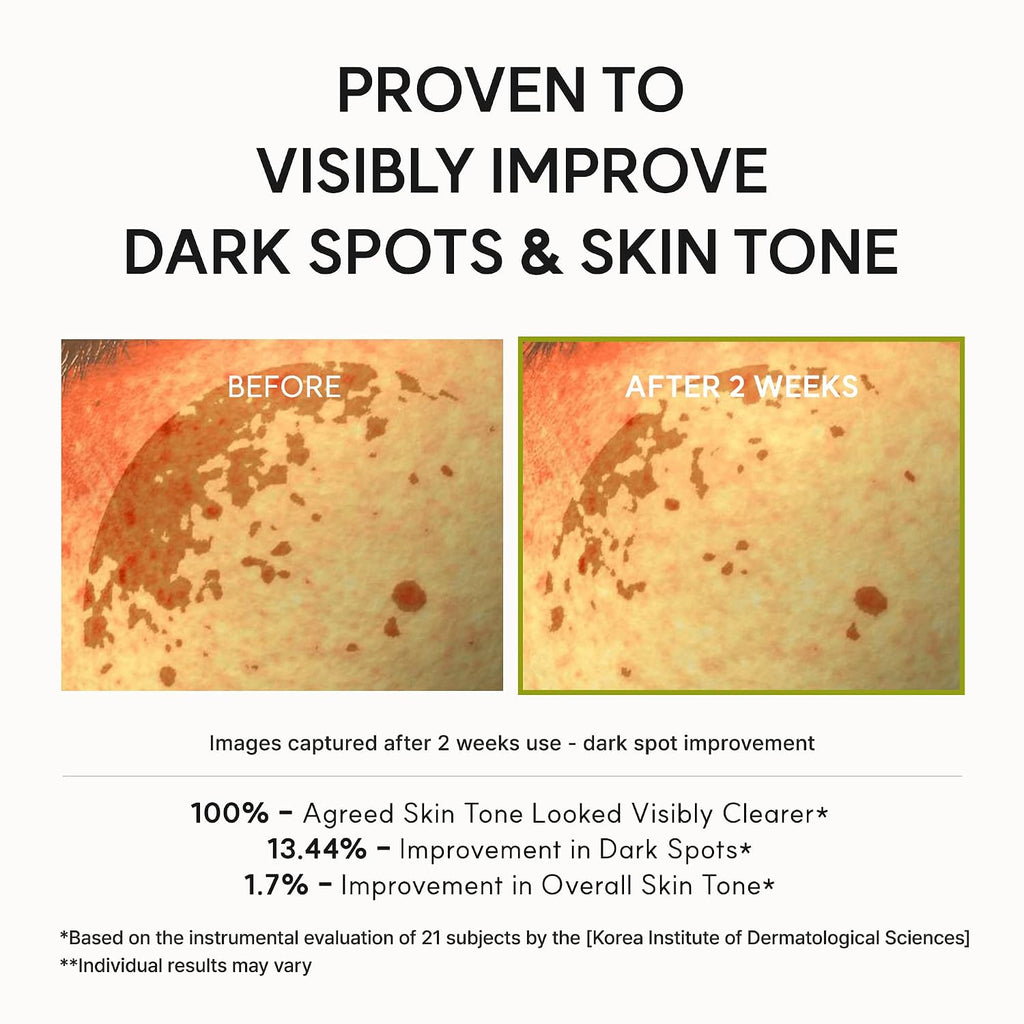 Arencia Vitamin C Booster Shot Serum With Glutathione, Niacinamide And Vitamin E For Dark Spot Care, Fine Lines & Wrinkles, Glass Skin, Korean Skincare 30Ml/1.01 Fl.Oz