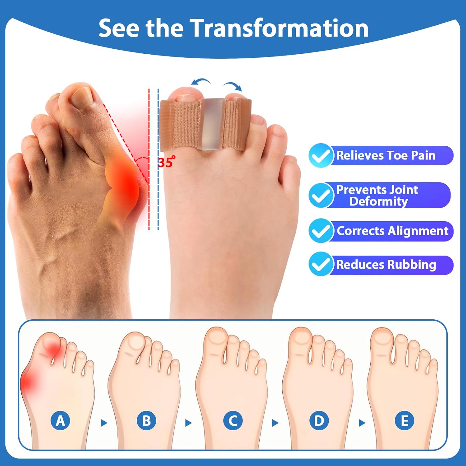 2-Pack Bunion Toe Separators for Overlapping Toes, 3-Point Support Gel Toe Spacers with 2 Fabric Lining Loops for Toe Protectors, Bunion Corrector for Women Men Big Toe(L)