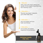 5% Minoxidil Hair Growth For Men And Women, Minoxidil Hair Growth Serum, Promotes Hair Growth, Strengthens Hair Follicles, Helps Prevent Hair Fall And Hair Loss