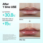 Anua Pdrn Lip Serum, Long-Lasting Hydration For Dry, Cracked Lips, Non-Sticky Moisturizing Lip Care With Salmon Dna, Hyaluronic Acid & Collagen, Korean Skincare, 0.33 Fl.Oz