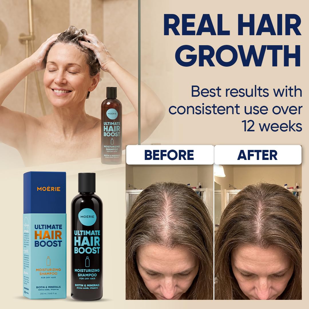 Moerie Hair Growth Shampoo For Men And Women, Hair Loss Solution With Biotin And Rosemary, Moisturizing Shampoo For Thinning Hair – Ultimate Boost For All Hair Types, Triple Set