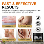 Adellina Urea Cream 40 Percent for Feet Maximum Strength, Urea Foot Cream for Dry Cracked Heels Feet Knees Elbows, 40% Urea Foot Repair Lotion 5.3 OZ