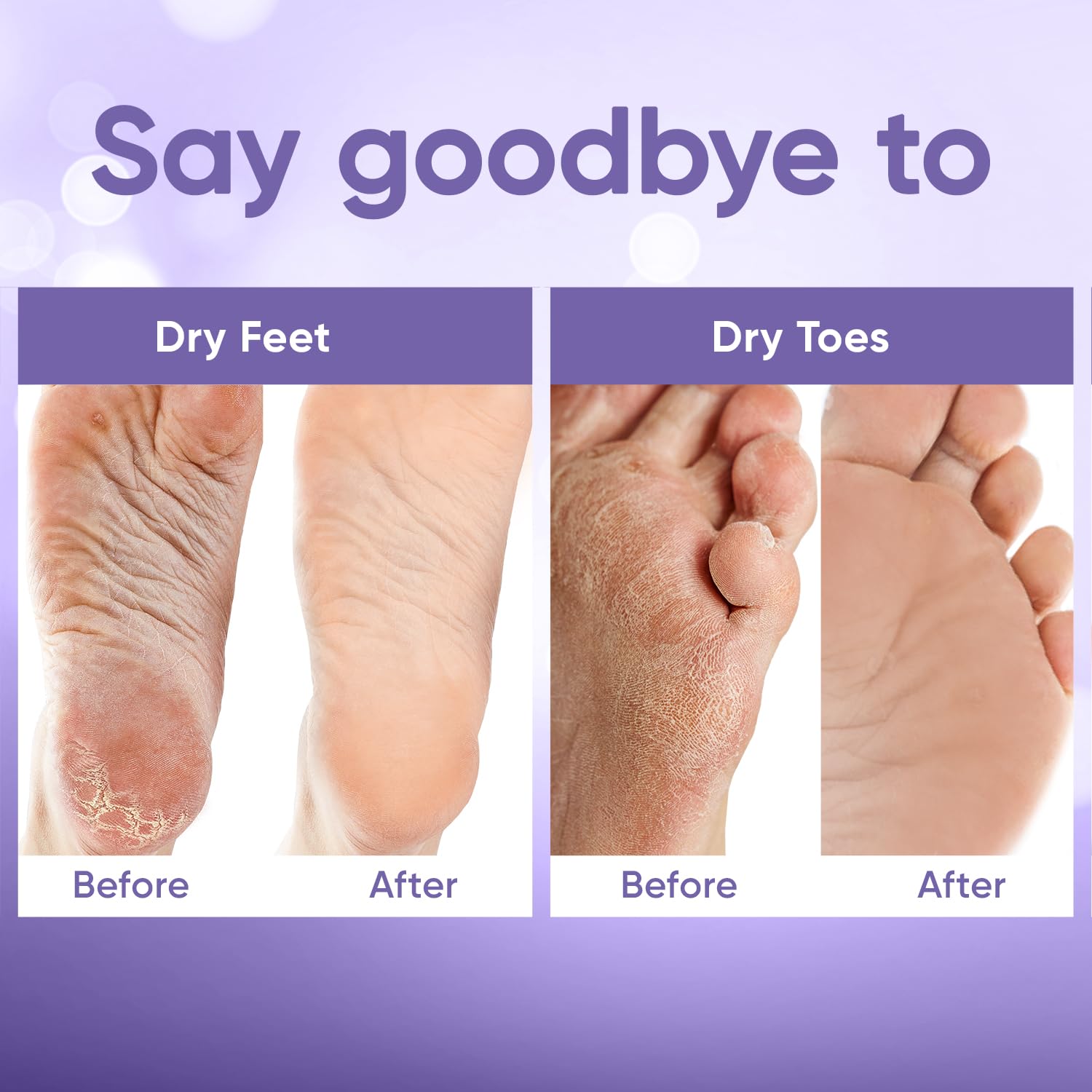 CÉLOR Foot Peeling Mask for Dry Cracked Feet | Foot Mask to Exfoliate Rough, Cracked, Dry Feet, Calluses for Soft Baby Feet Results | Made with Aloe Vera Extract for Women & Men (2 Pairs) | Lavender
