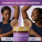 Hidradenitis Suppurativa Flare Defense Balm Cooling Formula: 2Oz Daily Protection For Flare-Prone, Bump-Prone, Friction-Prone Skin – Non-Greasy, Non-Staining – Microsilver Bg™, Zinc Oxide & Botanicals