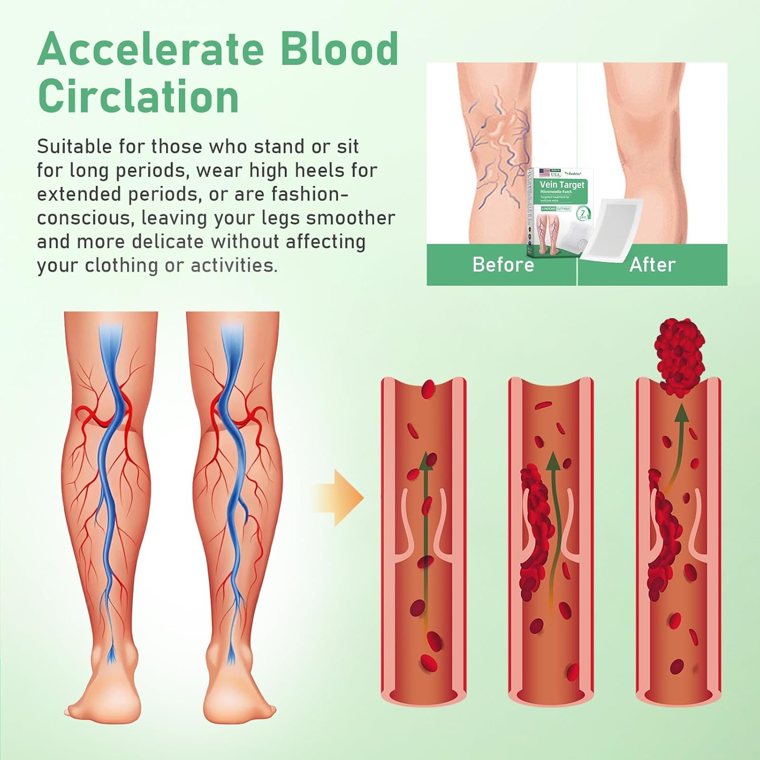 Healrize VeinTarget Microdarts Patch, Vein Target Microdarts Patch, Relieves Leg Discomfort, Moisturizes and Smooths Skin(3 Boxes)