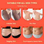 Enaskin Naturals Anti Cellulite Body Firming Cream: Tightening & Lifting Booty Lotion With 3D Thermal Tech For Thighs, Belly, Bum & Women Sagging Skin, Shea Butter & Coconut Oil, 3.4 Oz