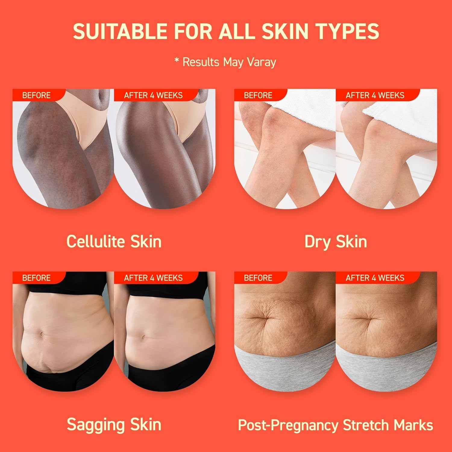 Enaskin Naturals Anti Cellulite Body Firming Cream: Tightening & Lifting Booty Lotion With 3D Thermal Tech For Thighs, Belly, Bum & Women Sagging Skin, Shea Butter & Coconut Oil, 3.4 Oz