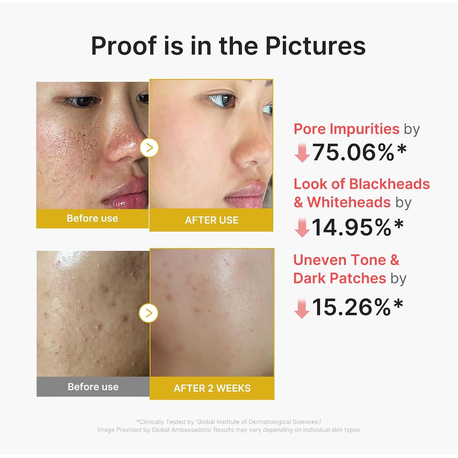 Medicube Peel Shot With Kojic Acid Turmeric | Reset In One Step | Gentle Exfoliating Serum With Bha, Lha, Pha For Dead Skin Cells, Blackheads, Excess Sebum | For Dull, Rough, Troubled Skin | 2.7 Fl.Oz