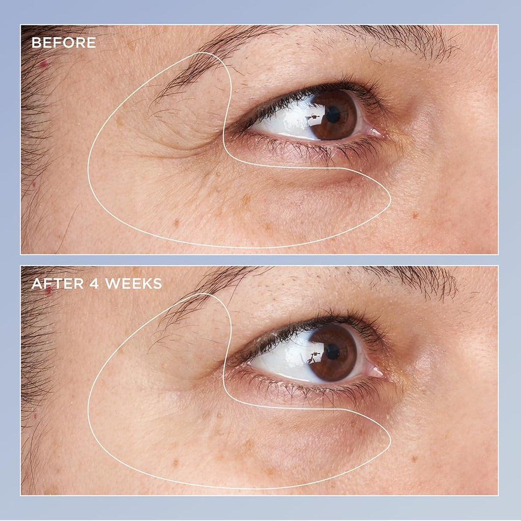 Perricone Md High Potency Triple Retinol Renewal Eye Serum - Retinol Serum With Coq10 & Beta-Carotene - Visibly Reduces Crow’S Feet, Wrinkles, & Discoloration For A Firmer, Smoother Skin - 0.5 Fl Oz