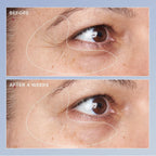 Perricone Md High Potency Triple Retinol Renewal Eye Serum - Retinol Serum With Coq10 & Beta-Carotene - Visibly Reduces Crow’S Feet, Wrinkles, & Discoloration For A Firmer, Smoother Skin - 0.5 Fl Oz