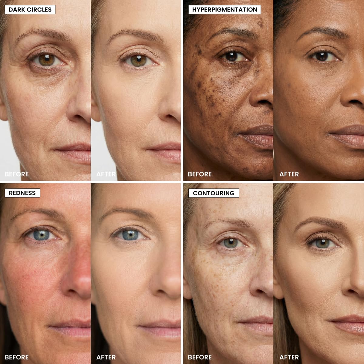 Prime Prometics Perfecting Concealer Pencil for Mature Women – Covers Dark Circles, Age Spots & Redness – Medium-to-High Coverage – 12-Hour Waterproof Wear – Self-Setting & Crease-Free (Almond Cream)