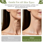 Crepe-Ease Body Moisturizer Anti Aging Retinol Cream Firming, Smoothing & Hydrating Cream For Crepey Skin On Neck, Arms & Legs Crepe Skin Repair, Advanced Crepe Fix, 4 Oz