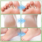 2Pcs Pure Tea Tree Oil Foot Cream with Vitamin E, Aloe Vera & Peppermint, Nourishing & Hydrating, for Dry Cracked Feet, Hands, Heels, Elbow, Nails, and Knees, Smooth Application-50g/1.764oz