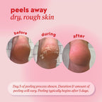Onyx Professional Foot Peel Mask Callus Remover, 2 pack - Dead Skin Remover, Foot Exfoliator, Cracked Heel Treatment, Peeling Callus Removing Foot Mask Pedicure Kit For Smooth Soft Healthy Feet