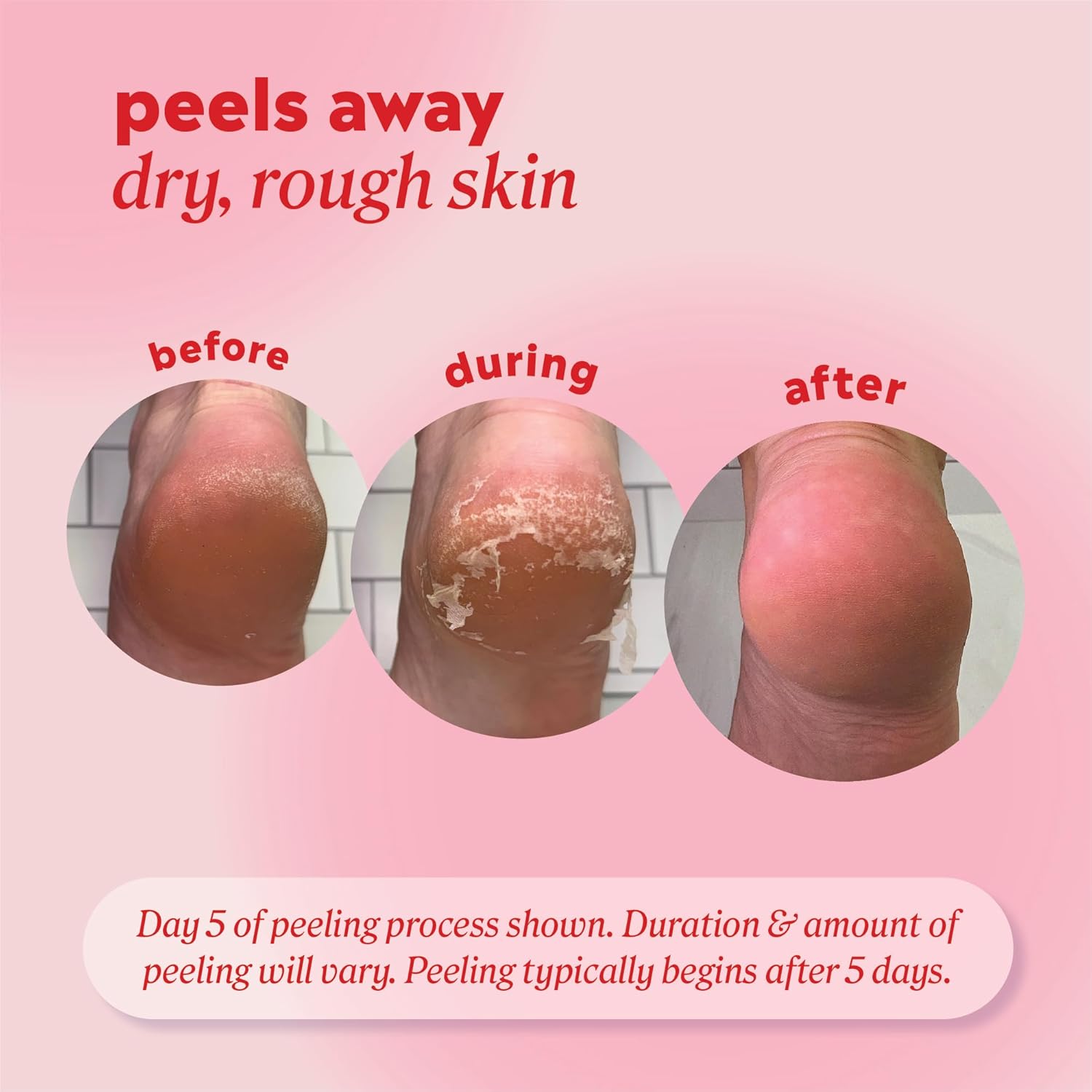 Onyx Professional Foot Peel Mask Callus Remover, 2 pack - Dead Skin Remover, Foot Exfoliator, Cracked Heel Treatment, Peeling Callus Removing Foot Mask Pedicure Kit For Smooth Soft Healthy Feet