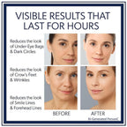 Instant Firming Eye Serum|Anti-Aging Formula For Under Bags And Wrinkles, Under Eye Cream-10Ml, Wrinkle Filler, Visibly Improves For Bags Dark Circles Treatment For Puffines