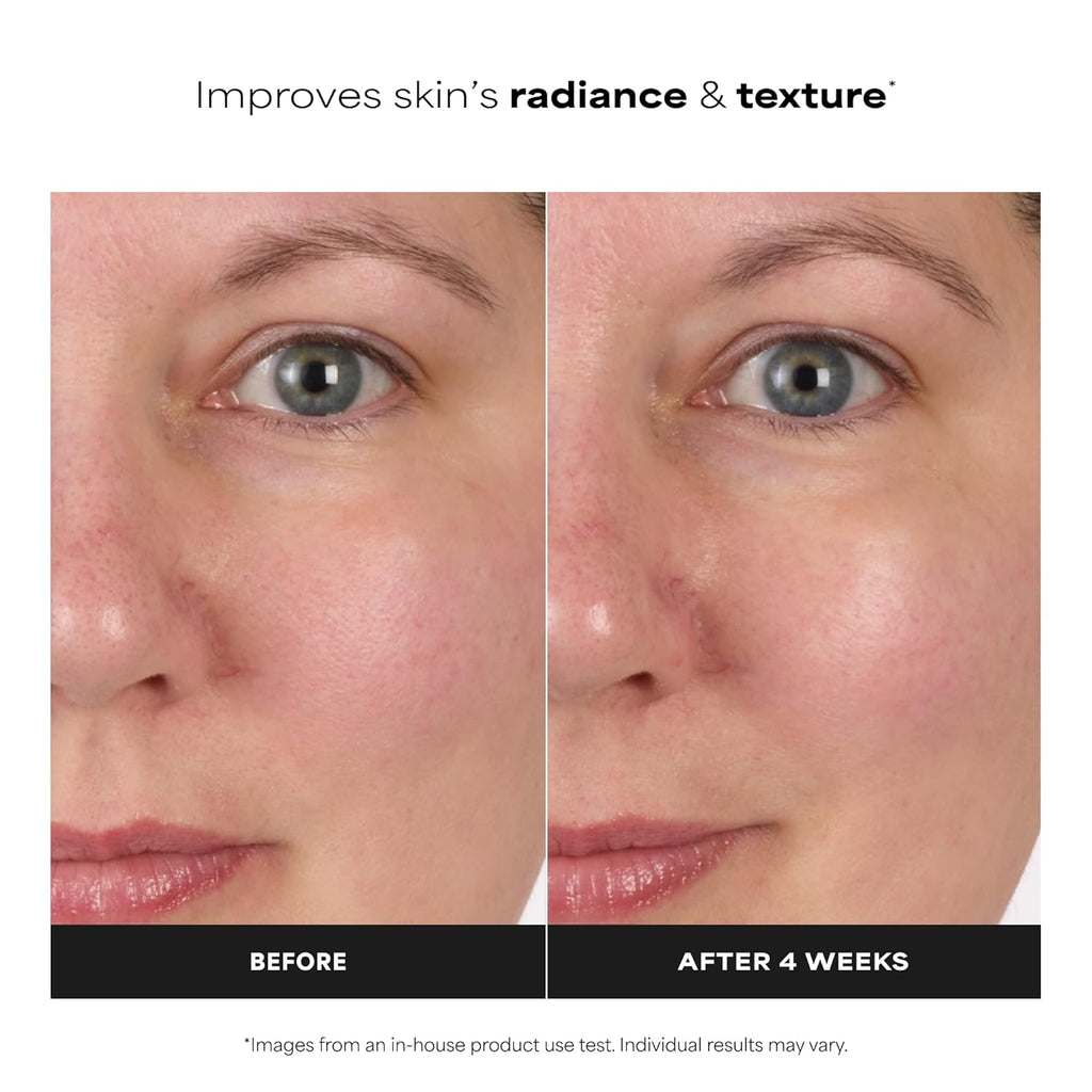 Paula's Choice SKIN BALANCING Pore-Reducing Face Toner with Niacinamide, for Oily Skin & Combination, Minimizes Large Pores, Controls Oil & Shine, Hydrates & Replenishes, Fragrance-Free