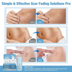 Silicone Scar Stick, 80% Silicone Stick For Face And Body. Silicone Stick For Removal Of Surgical,Old And Recent Scars And Stretch Marks - 7G