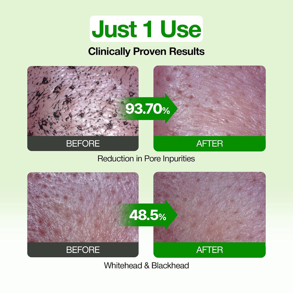 Fully Green Tomato Pore Cleanser, Cardi B’S Clay Mask Cleanser For Deep Pore Cleanse & Pore Minimizer, Blackhead & Sebum Control, Gentle Face Wash For Women, Korean Skincare