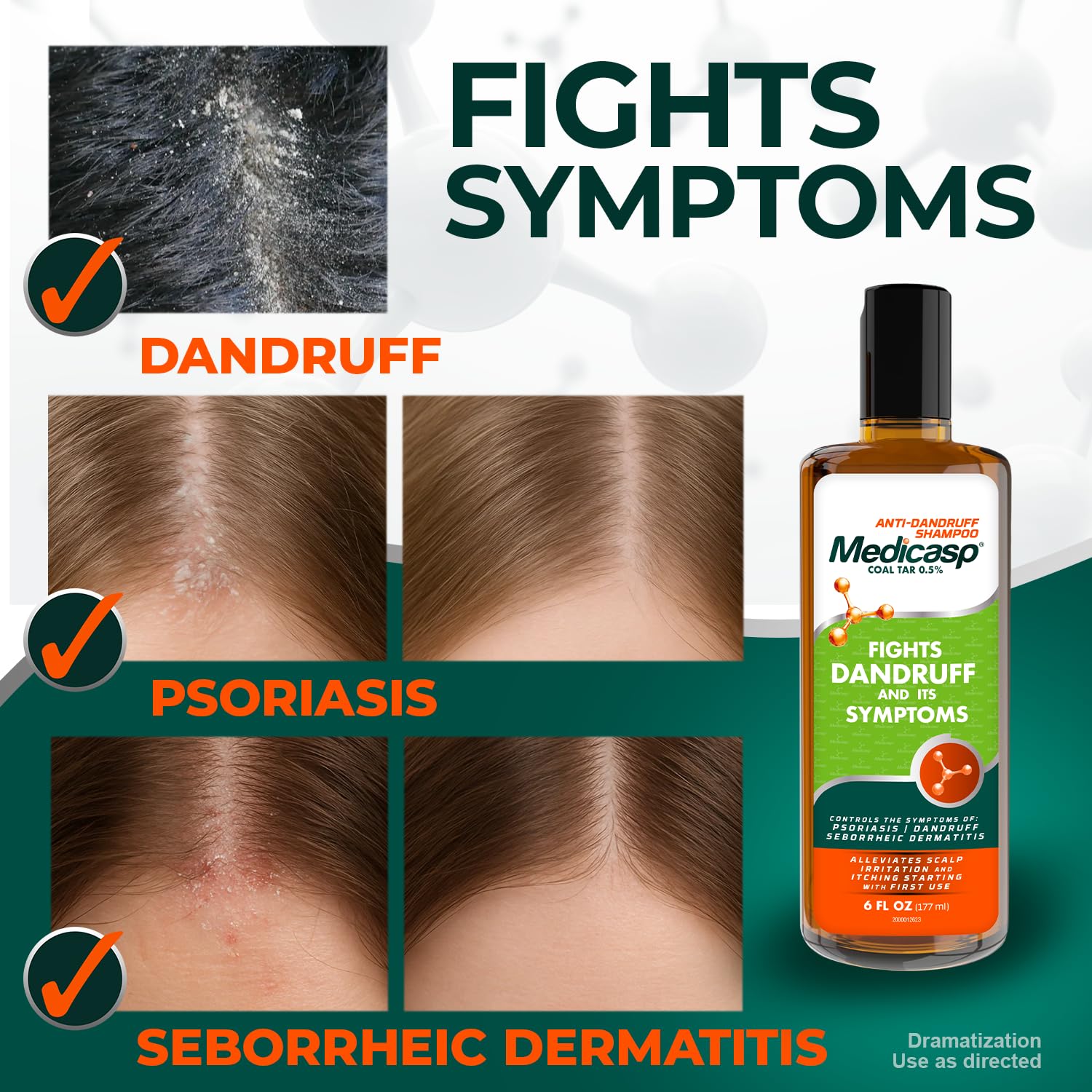 Medicasp Coal Tar Anti-Dandruff Shampoo, Alleviates Symptoms from 1st Wash, Treats Psoriasis, Seborrheic Dermatitis & Itchy Dry Scalp, Fights the Root Cause of Dandruff, Flakes Shampoo, 6 fl oz