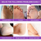 ALIVER Foot Peeling Mask - 5 Pack, Exfoliating Mask Make Feet Baby Soft, Foot Mask for Dry Cracked Skin, Peeling Away Dead Skin, Calluses - Lavender