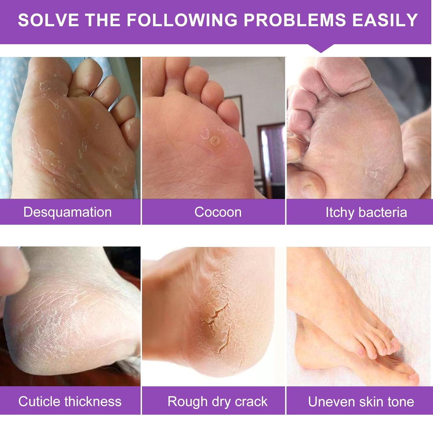 ALIVER Foot Peeling Mask - 5 Pack, Exfoliating Mask Make Feet Baby Soft, Foot Mask for Dry Cracked Skin, Peeling Away Dead Skin, Calluses - Lavender
