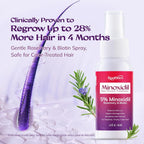 Women's 5% Minoxidil Spray for Hair Growth: RootStim Extra Strength Minoxidil with Rosemary & Biotin for Thinning Hair Regrowth and Fuller Hair - 2 Fl Oz
