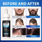 5% Minoxidil for Men, Minoxidil for Women Hair Growth Treatment, Beard Growth Serum, Biotin & Castor Oil Enriched,Strengthens Weak Roots, Repairs Thinning Hair (120ml)
