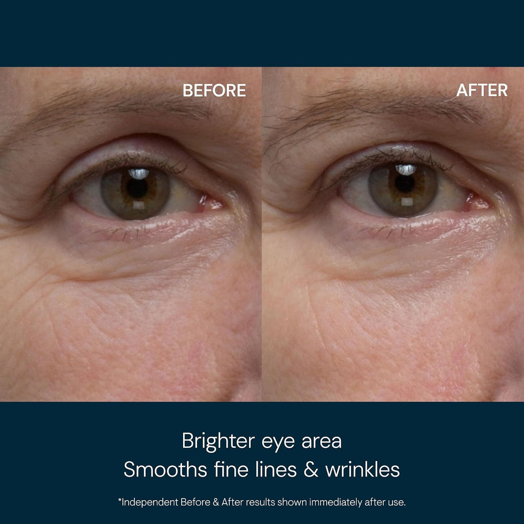 Elemis Pro-Collagen Eye Revive Mask | Anti-Wrinkle Multi-Use Treatment Brightens, Rejuvenates, Plumps And Hydrates For A More Youthful Look