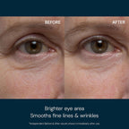 Elemis Pro-Collagen Eye Revive Mask | Anti-Wrinkle Multi-Use Treatment Brightens, Rejuvenates, Plumps And Hydrates For A More Youthful Look