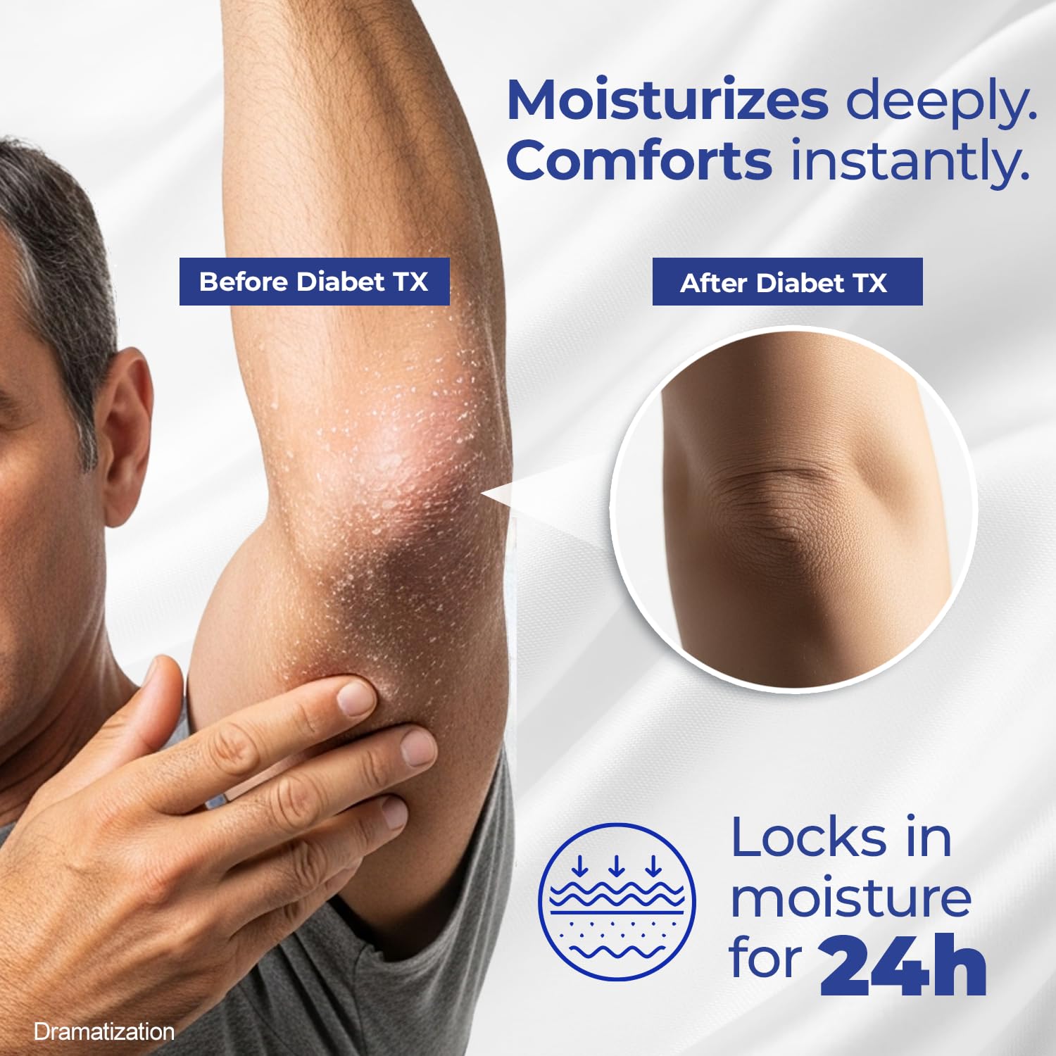 Goicoechea Diabet Tx Diabetic Lotion With Urea For Dry Skin | Soothing Hydrating Cream With Aloe, Oatmeal & Vitamin E For Hands, Elbows, Feet & Body | Extra Dry Skin Support, 13.5 Oz | 1-Pack