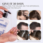 Biotin & Rosemary Shampoo For Hair Growth: Hair Loss Shampoo For Thinning Hair Infused With Natural Nutrient Rich Ingredients For Hair Thickening Sulfate Free 10 Fl Oz