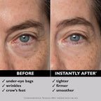 Peter Thomas Roth | Instant Firmx® Eye Temporary Eye Tightener