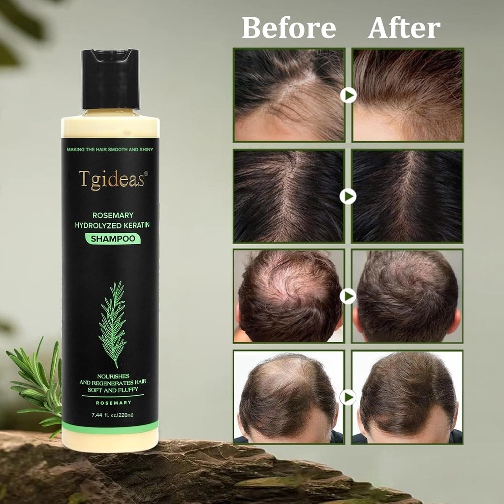 Rosemary & Biotin Shampoo For Thinning Hair, Volumizing Shampoo For Fuller, Thicker Hair, Strengthening & Nourishing Formula With Root Lift, Gentle Daily Care For Women & Men (7.4 Fl Oz)
