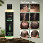 Rosemary & Biotin Shampoo For Thinning Hair, Volumizing Shampoo For Fuller, Thicker Hair, Strengthening & Nourishing Formula With Root Lift, Gentle Daily Care For Women & Men (7.4 Fl Oz)