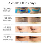Electric Vibrating Eye Cream For Puffiness Bag Under Eye | Exosome & Pdrn Ems Eye Tightener Cream For Dark Circle | Nad+, Caffeine, Peptide, Collagen | For Firming, Reducing Wrinkles (0.88 Oz)