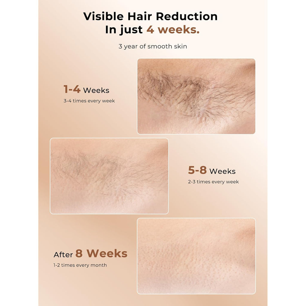 Ubroo Laser Hair Removal with 5℃ Ice Cooling,Hand-held Hair Removal Device IPL Hair Removal for Women and Men,Reduce Hair Regrowth,Full Body Use for Legs,Bikini,Armpits（Gold）
