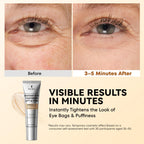 Ronkie Instant Firm Eye Tightener: Upgraded Formula For Women Helps Reduce Eye Bags Puffiness And Wrinkles In 3-5 Minutes When Time Matters 0.67 Oz