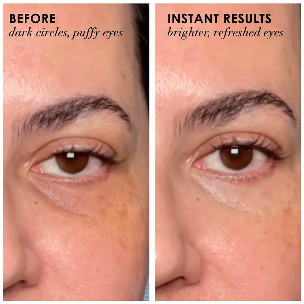 Dermelect Revitalite Eyelid & Dark Circle Corrector- Professional Strength, Anti-Aging Eye Cream With Peptides, Brightening & Tightening Ingredients- Dark Circles, Puffiness, Droopy Eyelids & Wrinkles