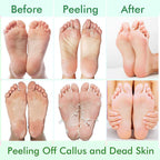 5 Pack Foot Peeling Mask,Exfoliator Peel Off Calluses Dead Skin Callus Remover,Foot Mask for Dry Cracked Feet,Foot Peel Masks for Men and Women Feet Peeling Mask for Fathers Mothers Day Gifts