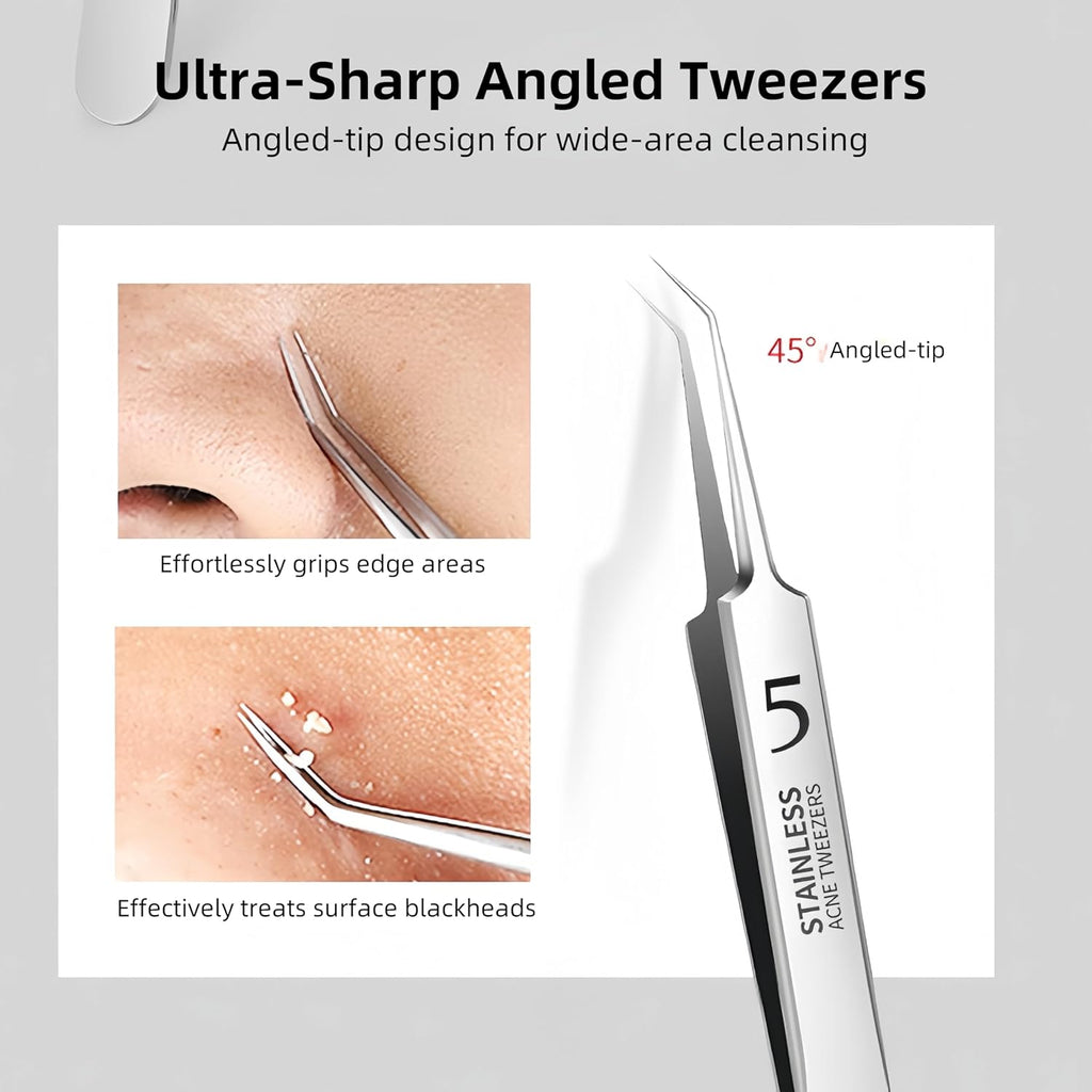 3 Pieces Removal Blackhead Tweezers Precision,Stainless Steel Extractor Acne Removal Kit Pimple Popper Tool, Clip for Whiteheads, Acne Clip, Ingrown Hairs Tweezers